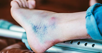 ankle injury treatment doctor