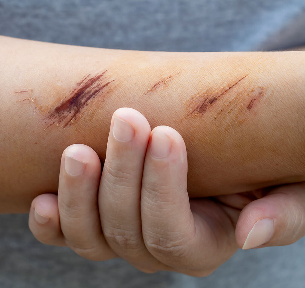 Treatment for lacerations and cuts: diagnosis from a medical doctor